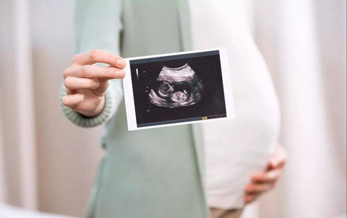 生育保險待遇調(diào)整的通知